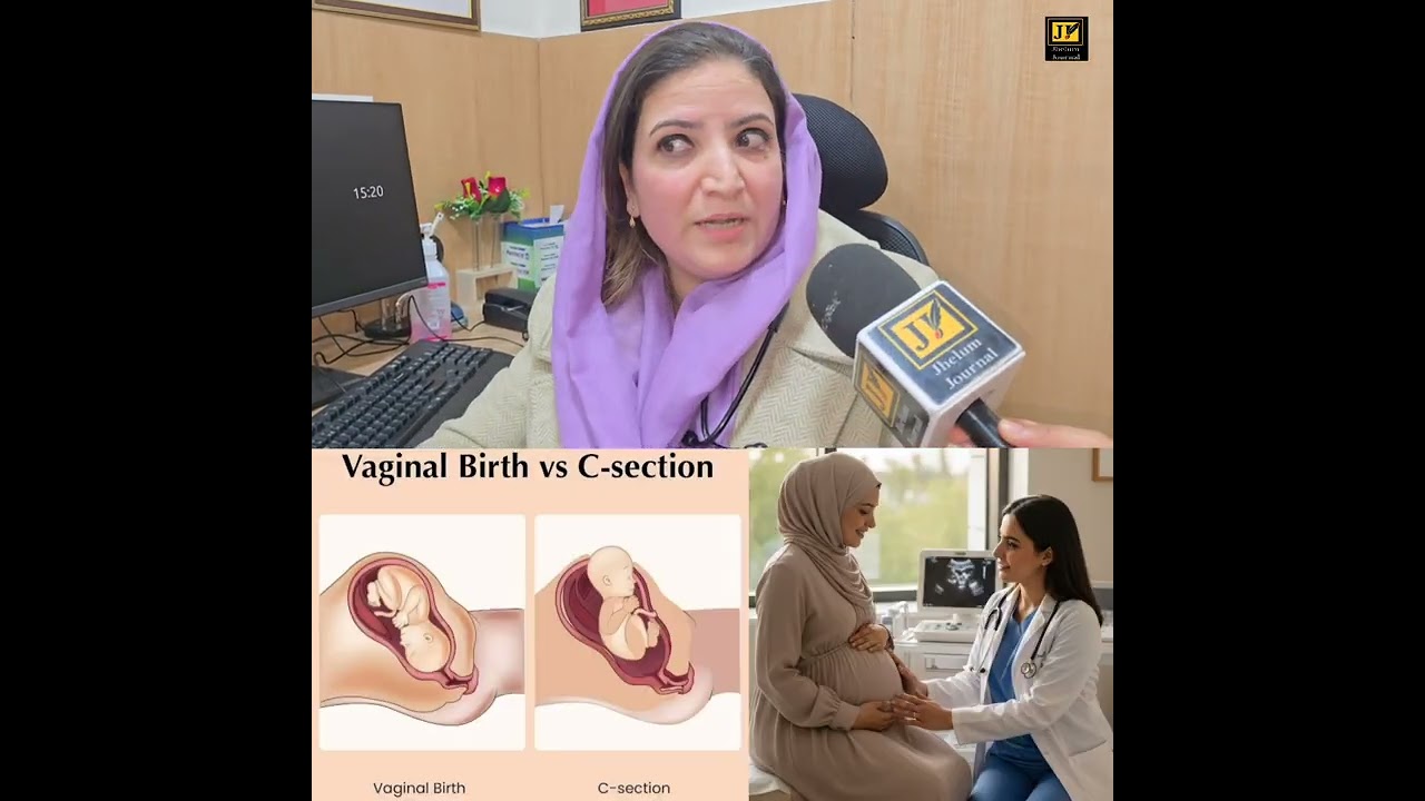 Vaginal delivery vs LSCS Delivery in #Pregnant women. 