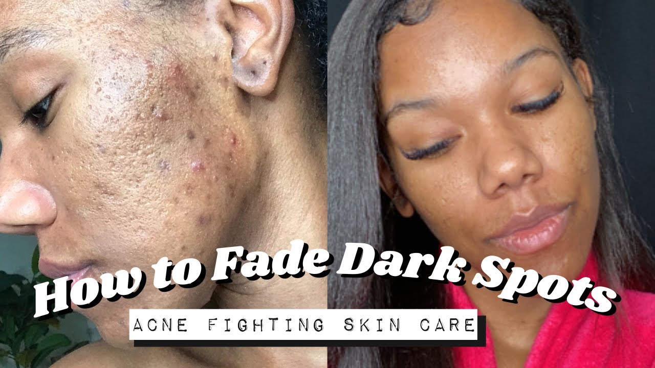 How to Fade Dark Spots | Morning Skincare Routine ft NEW hero cosmetics lightning swipe
