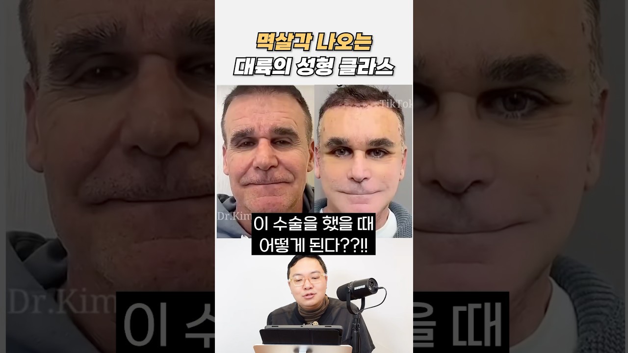 중국 대륙의 미쳐버린 성형수술