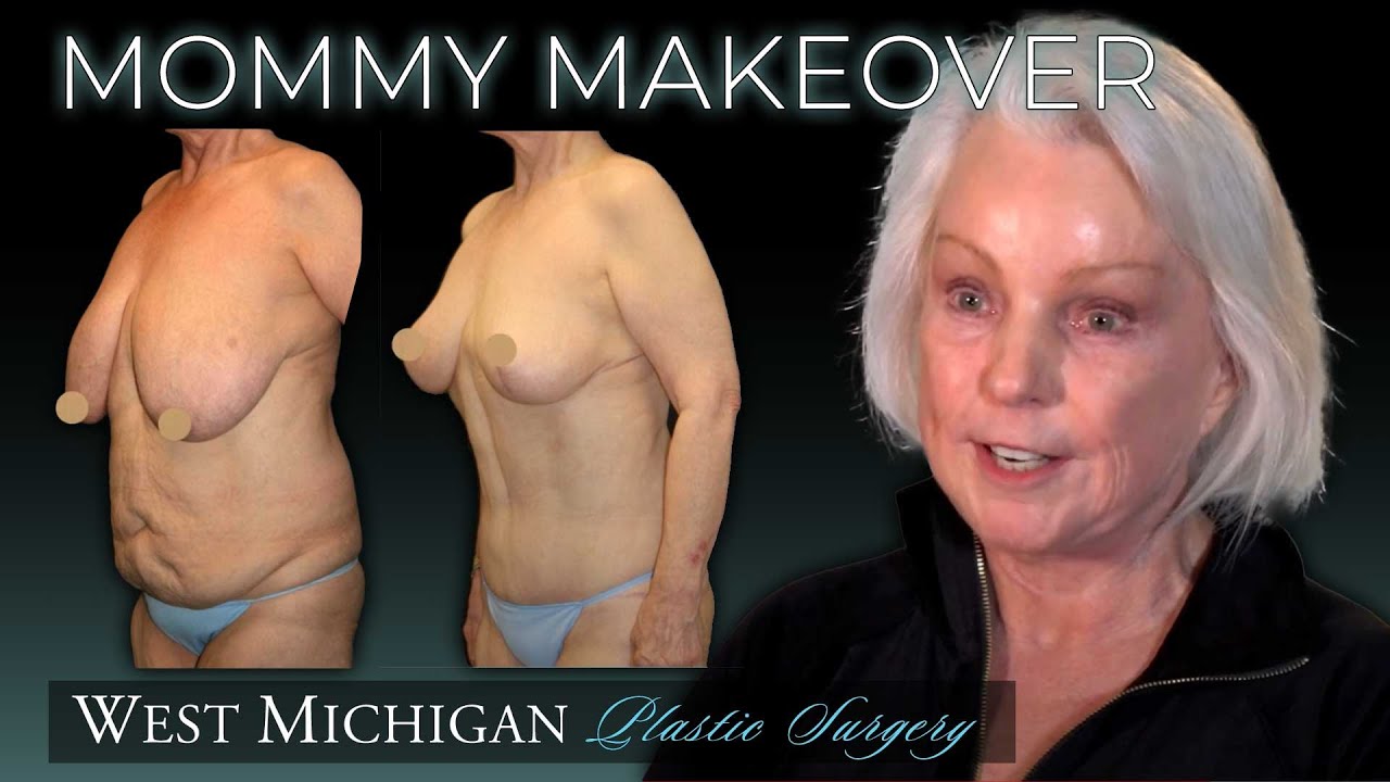 AMAZING MOMMY MAKEOVER - Surgery After #WeightLoss