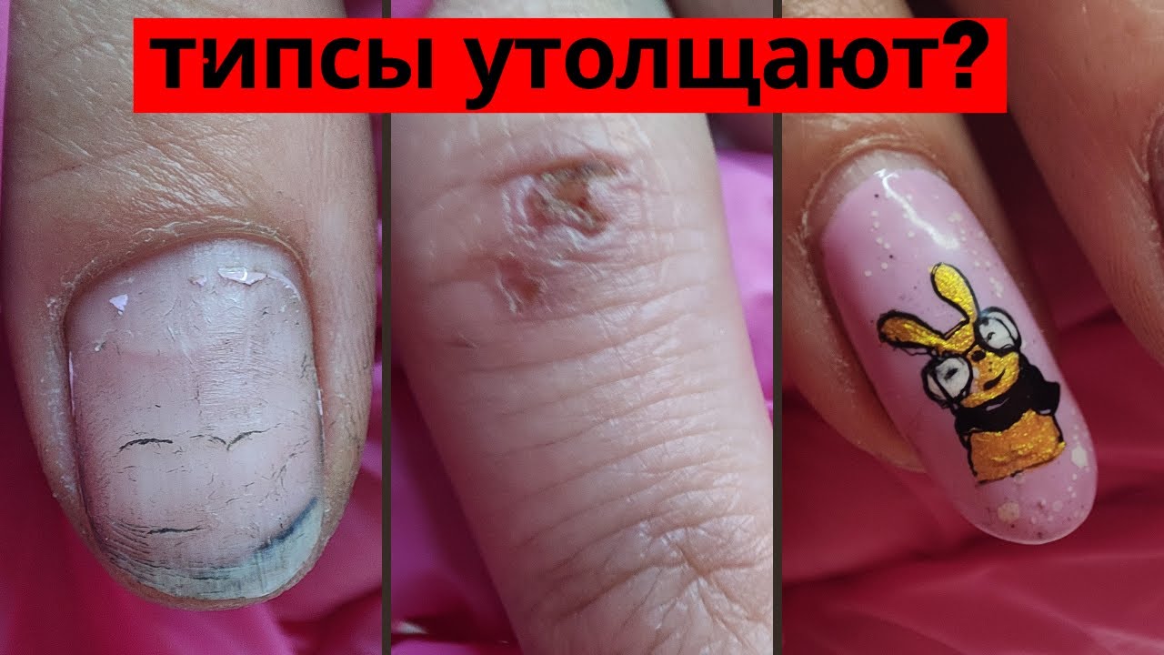 ПЕРЕНАРАЩИВАНИЕ // ДИЗАЙН НА ВСЕХ НОГТЯХ