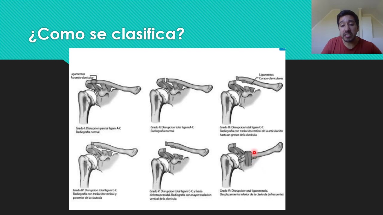Esguinces grado 1 - Traumatología - Reforzamiento Académico UCM