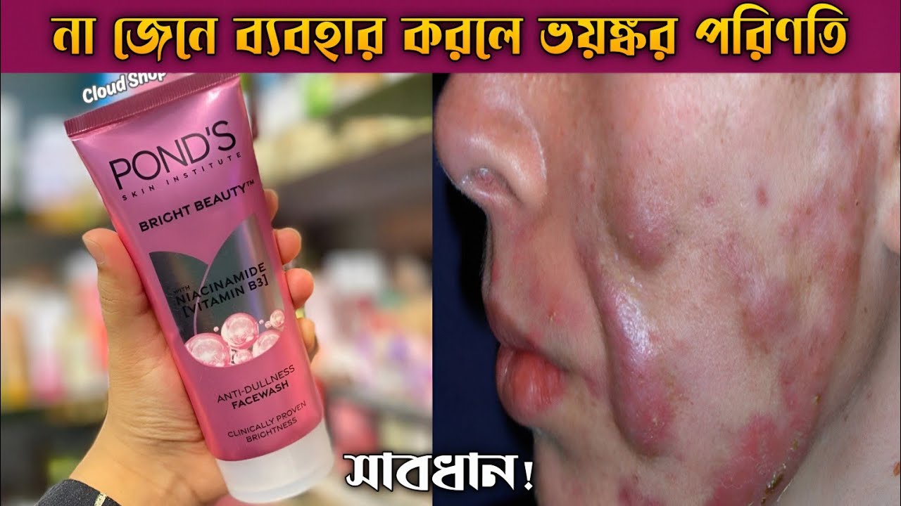 ত্বক ফর্সা করার ফেসওয়াশ | Ponds bright beauty anti dullness face wash review|ponds face wash review