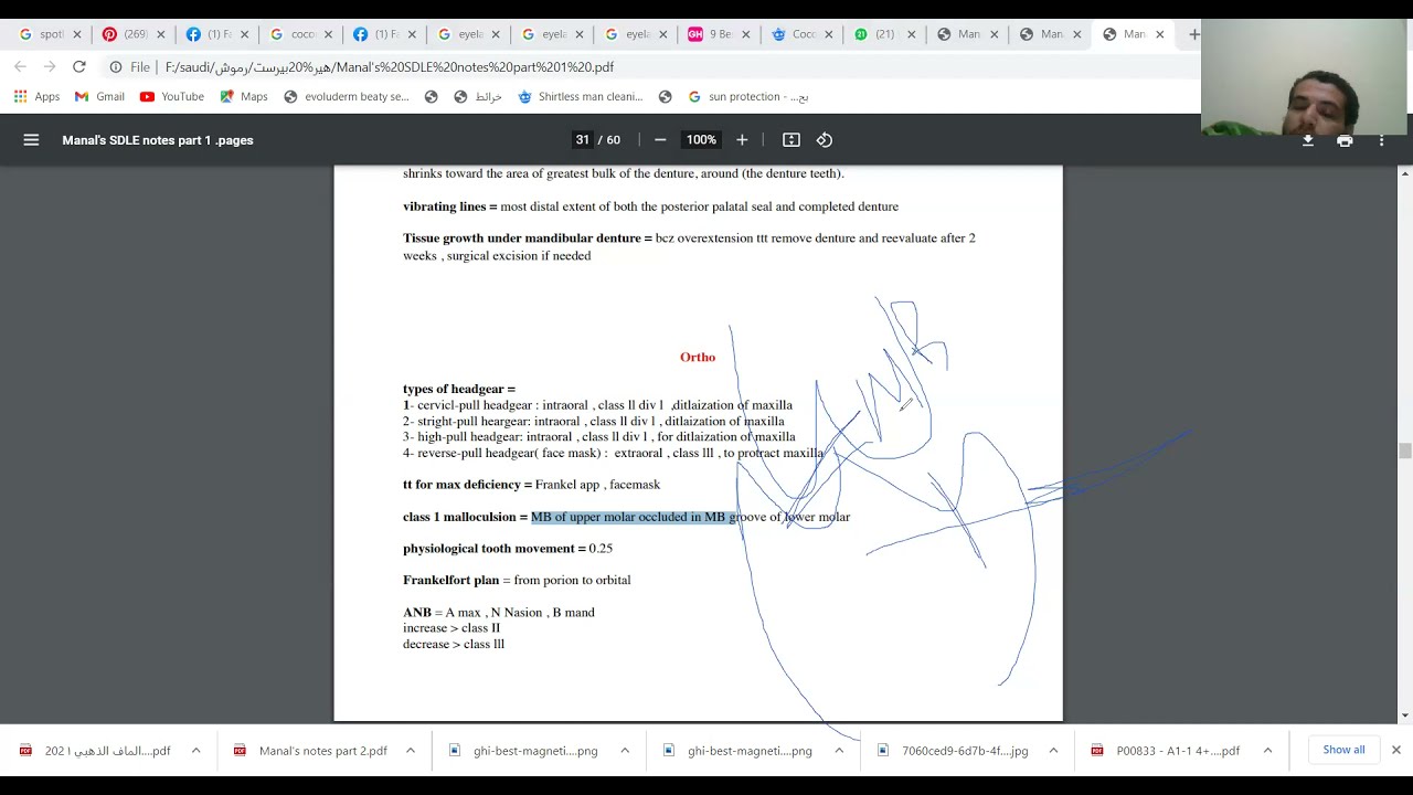 كبسوله اورثو  مع بيدو في السريع 😁😁😁😁