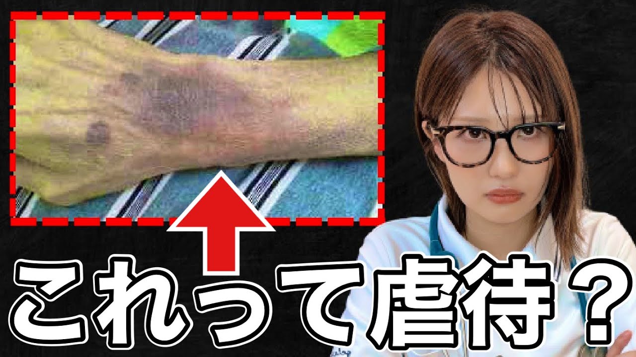 病院内の虐待の実態【閲覧注意】