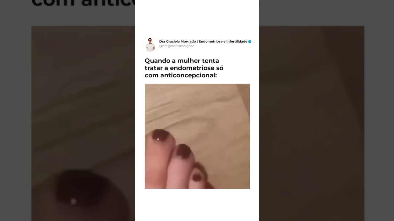 Quando a mulher tenta tratar a endometriose s&oacute; com anticoncepcional