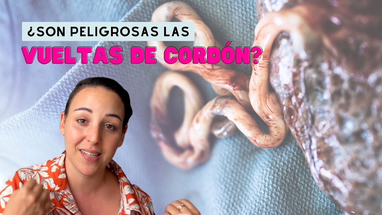 Vueltas de cordón en el parto ¿Son normales? ¿Tengo que preocuparme? ¿Mi bebé está en peligro?