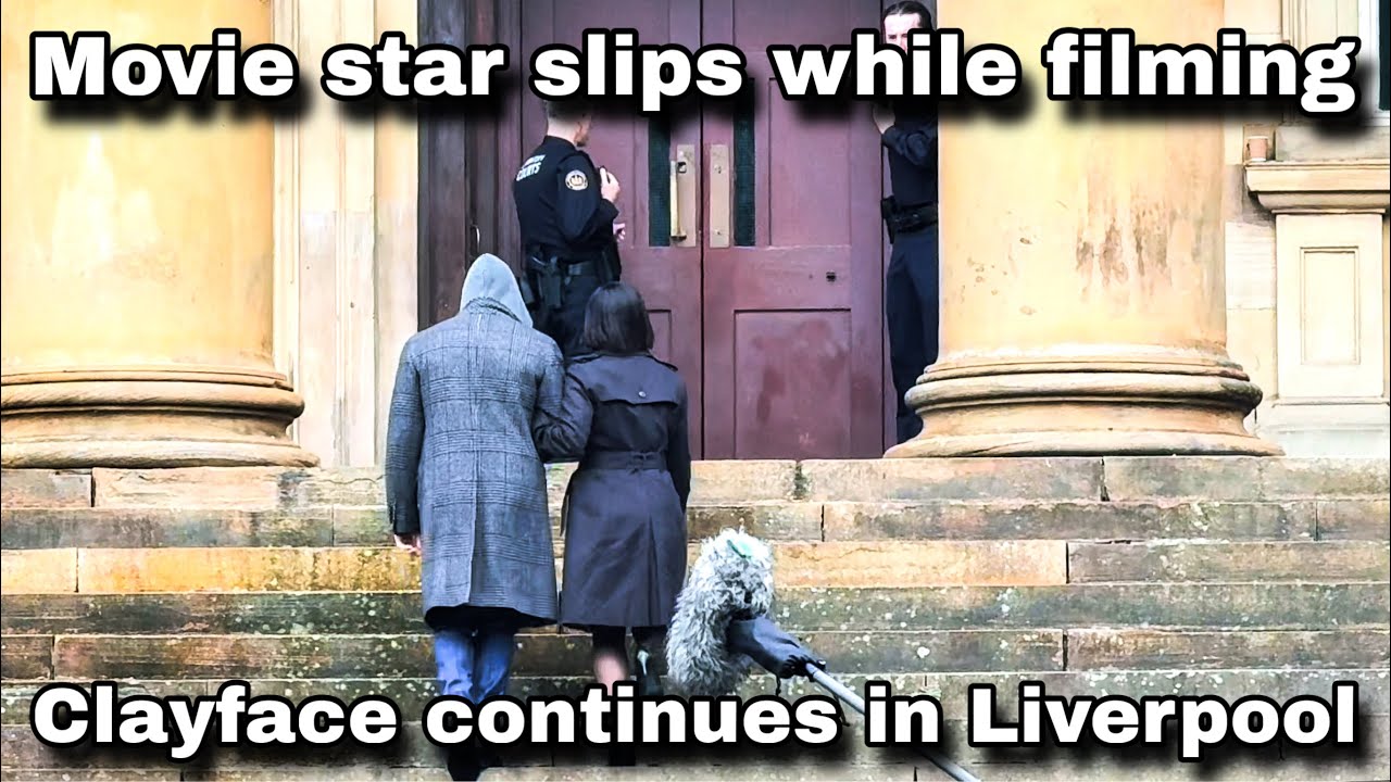 Movie star slips while filming in Liverpool