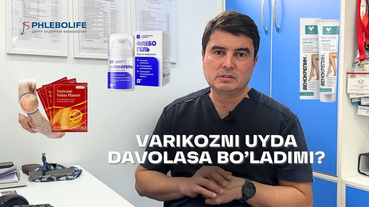 VARIKOZNI UYDA DAVOLASA BO'LADIMI? | 25 yillik ILMIY FLEBOLOGdan to'liq JAVOB