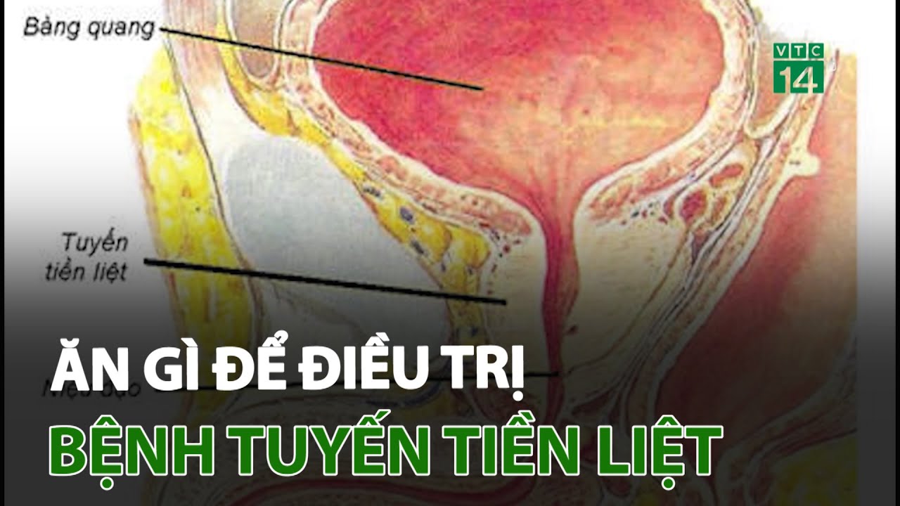 Nên, không nên ăn gì để phòng và điều trị bệnh tuyến tiền liệt | VTC14