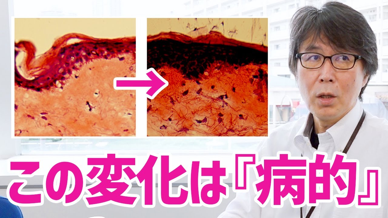 続・肌再生の専門家が安易に『レチノール』を使ってはいけない理由を解説します