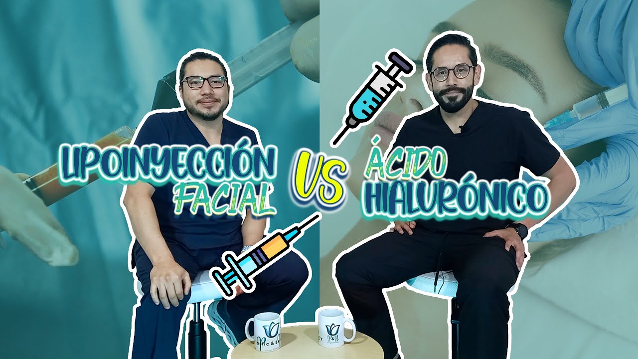 Ácido hialurónico vs Lipoinyección facial - Rellenos faciales