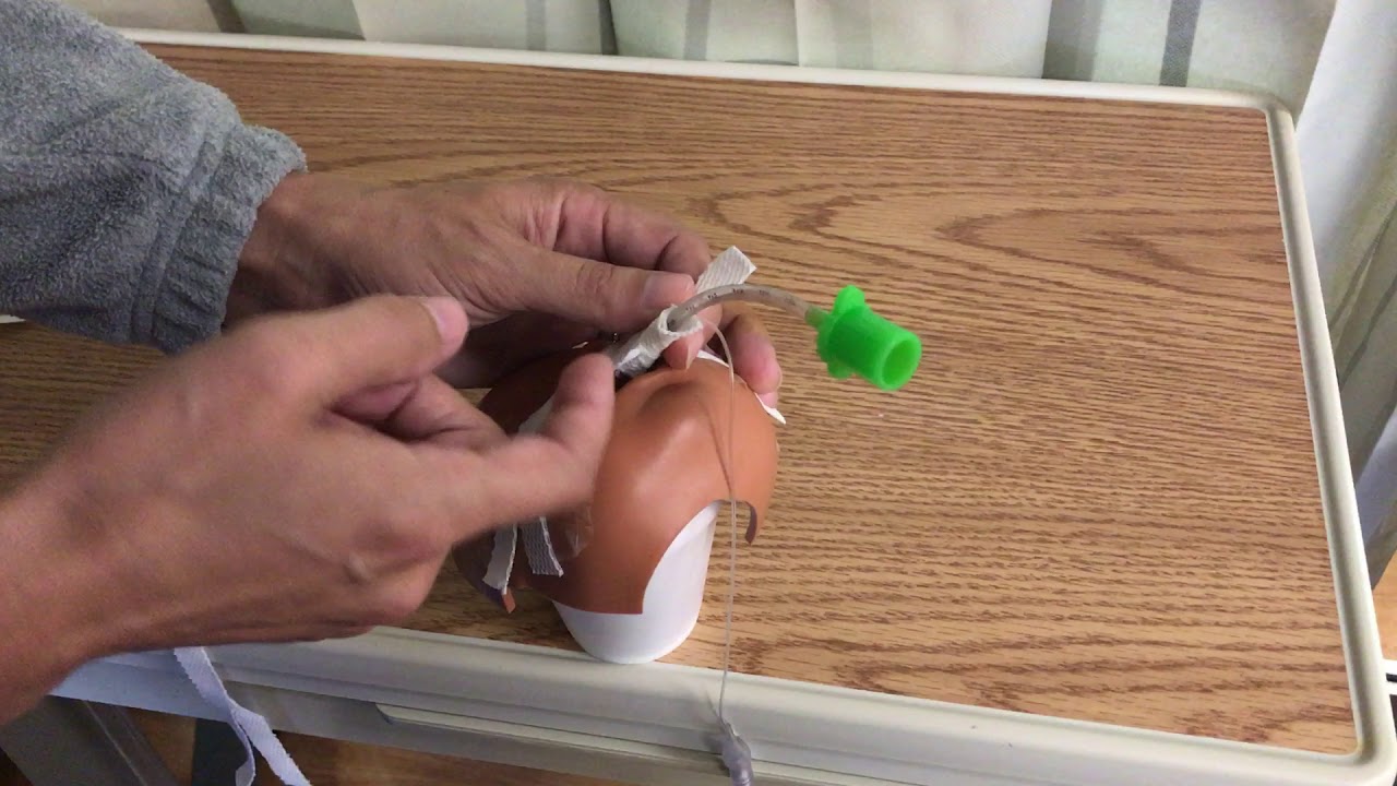 The wrong way to tape an ETT