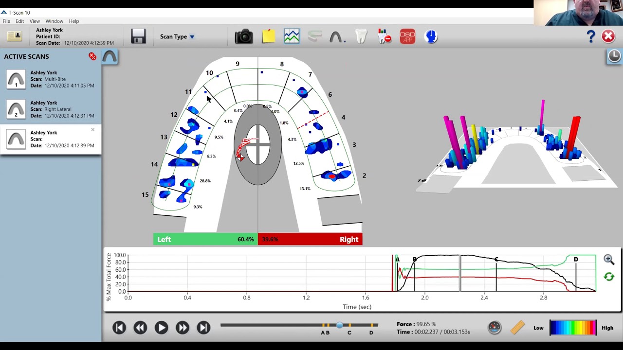 T-Scan Virtual Demonstration Featuring Dr. Ben A. Sutter