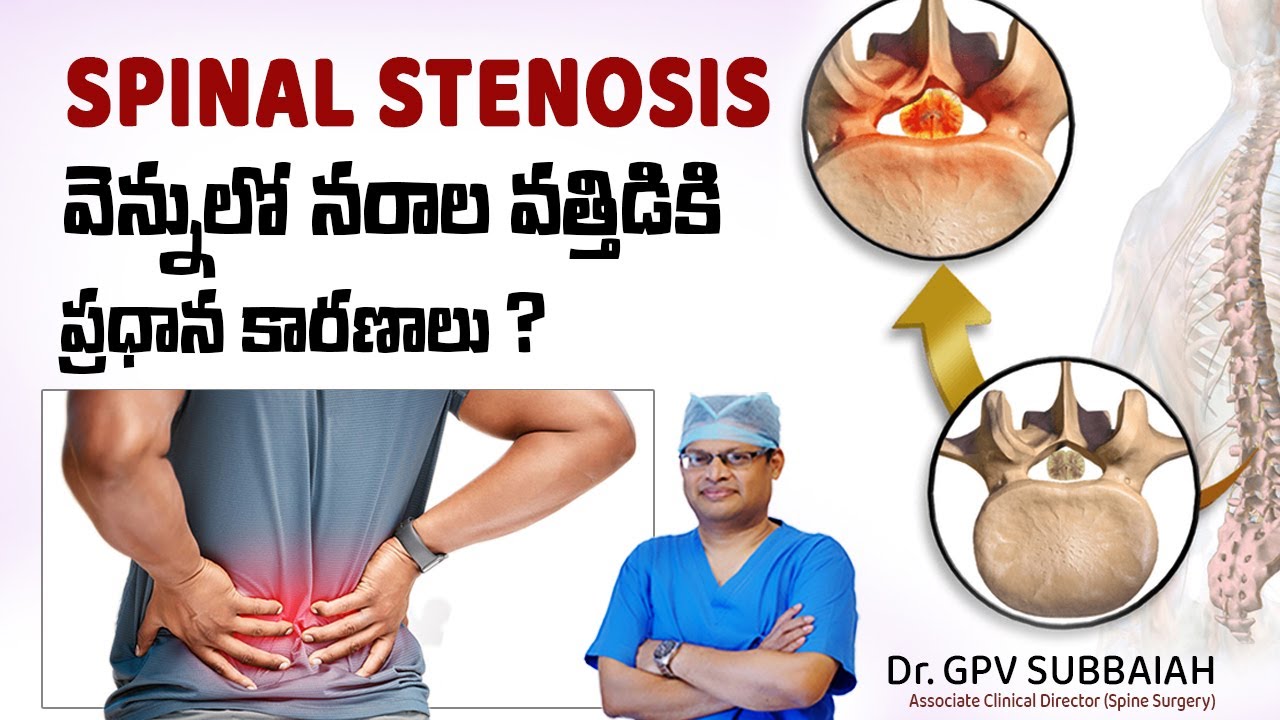 Causes of spinal stenosis | నడుము నొప్పి | Back pain | Low back pain relief | Dr GPV Subbaiah