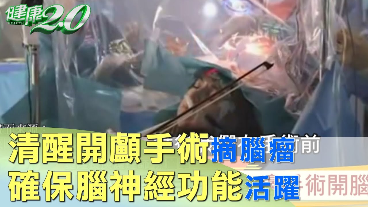 清醒開顱手術摘腦瘤 確保腦神經功能活躍 健康2.0