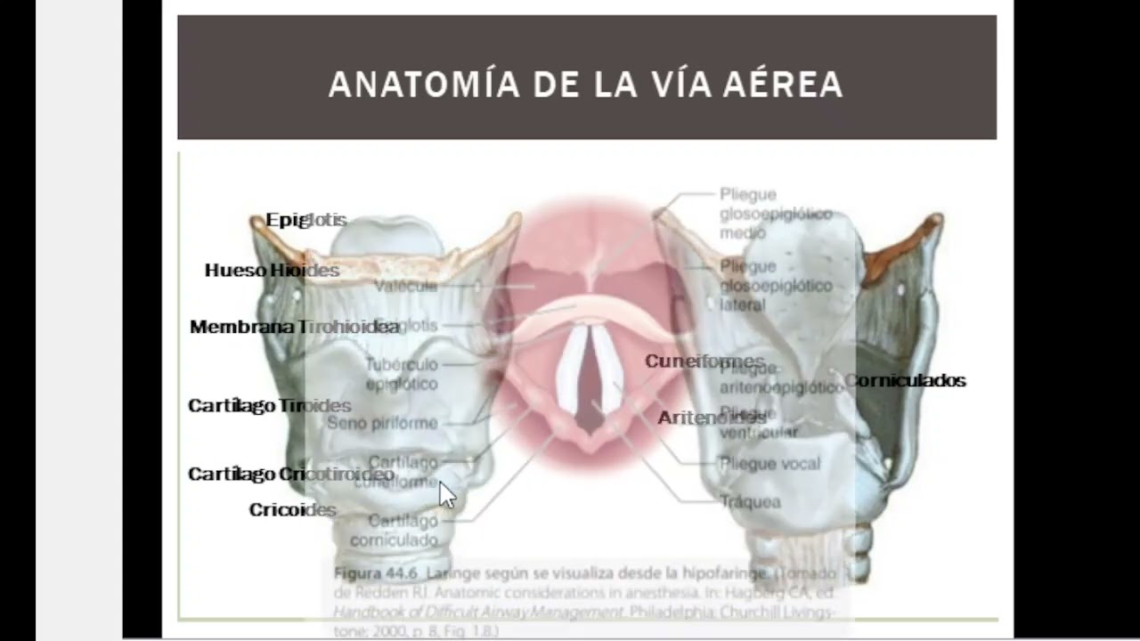 Predictores Vía Aérea Dificultosa / Santos 2024