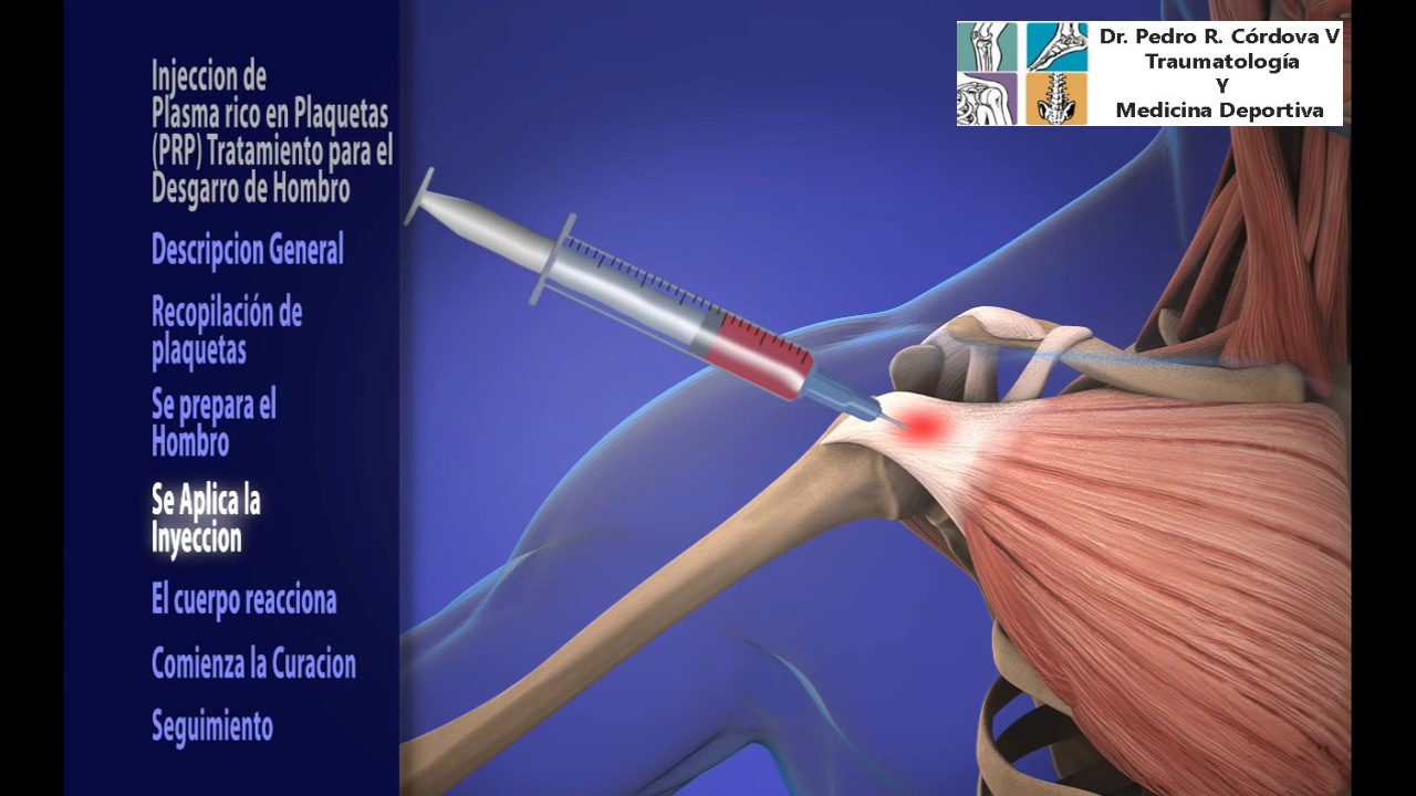 PRP LESIONES HOMBRO