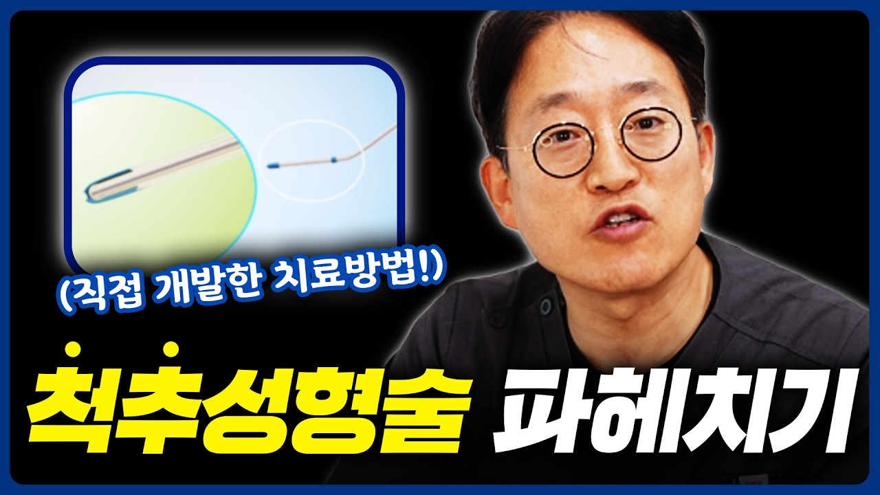 척추성형술이 대체 뭔가요?