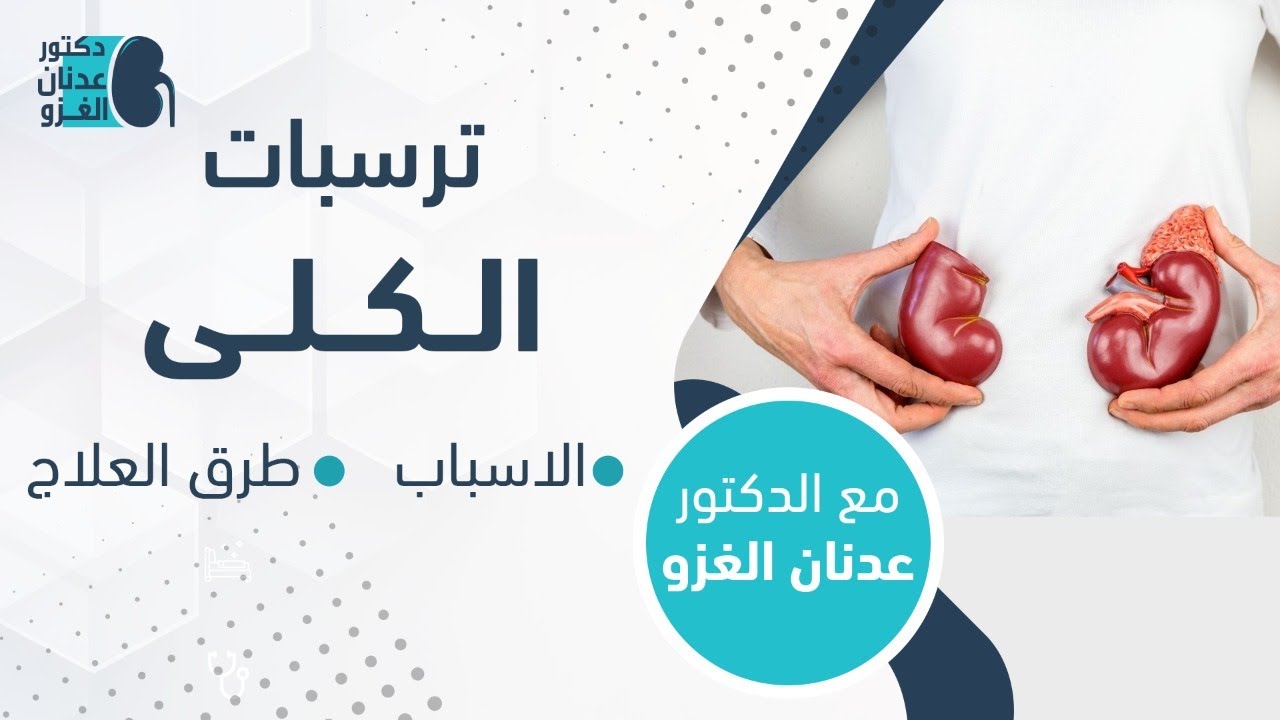 ترسبات الكلى | اعراض ترسبات الكلى وطرق علاجها