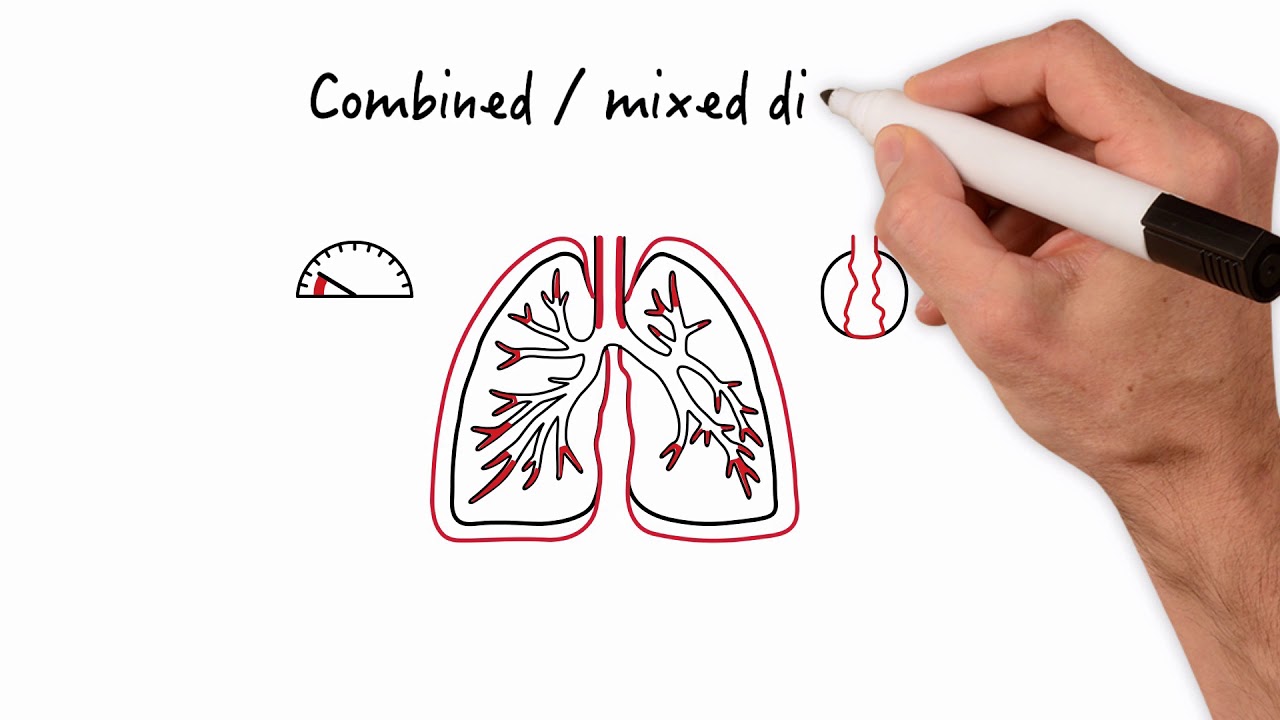 Deciphering Abnormal Pulmonary Function Tests (PFT): Diagnostic Insights