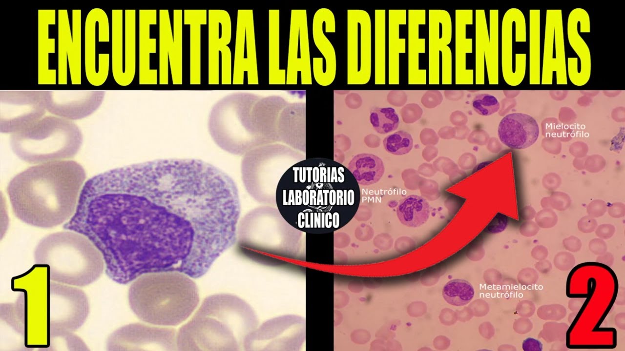 🩸Cómo Identificar Células Sanguíneas INMADURAS de la LÍNEA(Serie) BLANCA-(Hematología) Medicina🔬