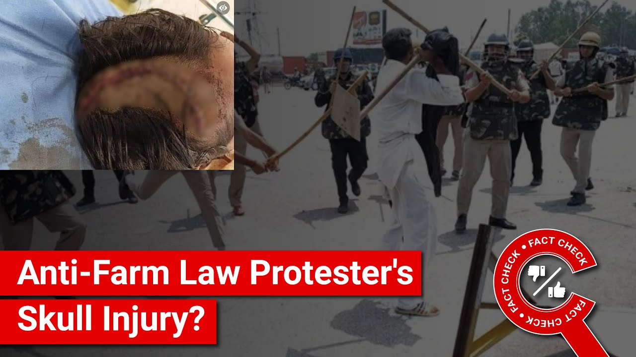 FACT CHECK: Does Image Show Protesting Farmer's Skull Injury from Lathi Charge?