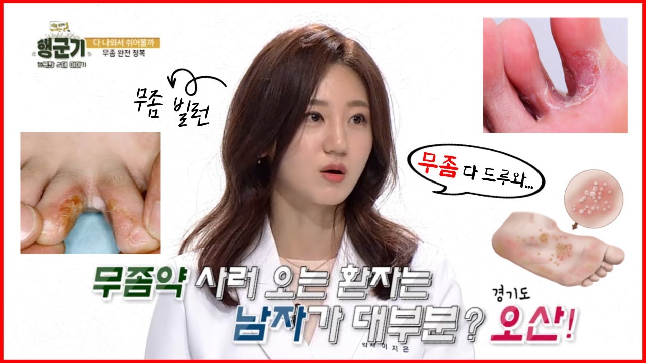 무좀 완치 대백과ㅣ발 무좀, 발톱 무좀 정복해서 방송 탄 무좀 빌런 으니약사ㅣ행군기 295회