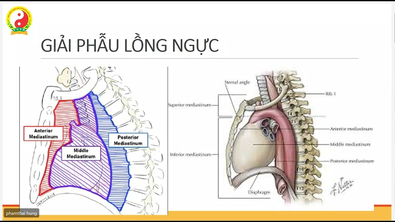 Chấn Thương Ngực - Vết Thương Ngực (VUTM)