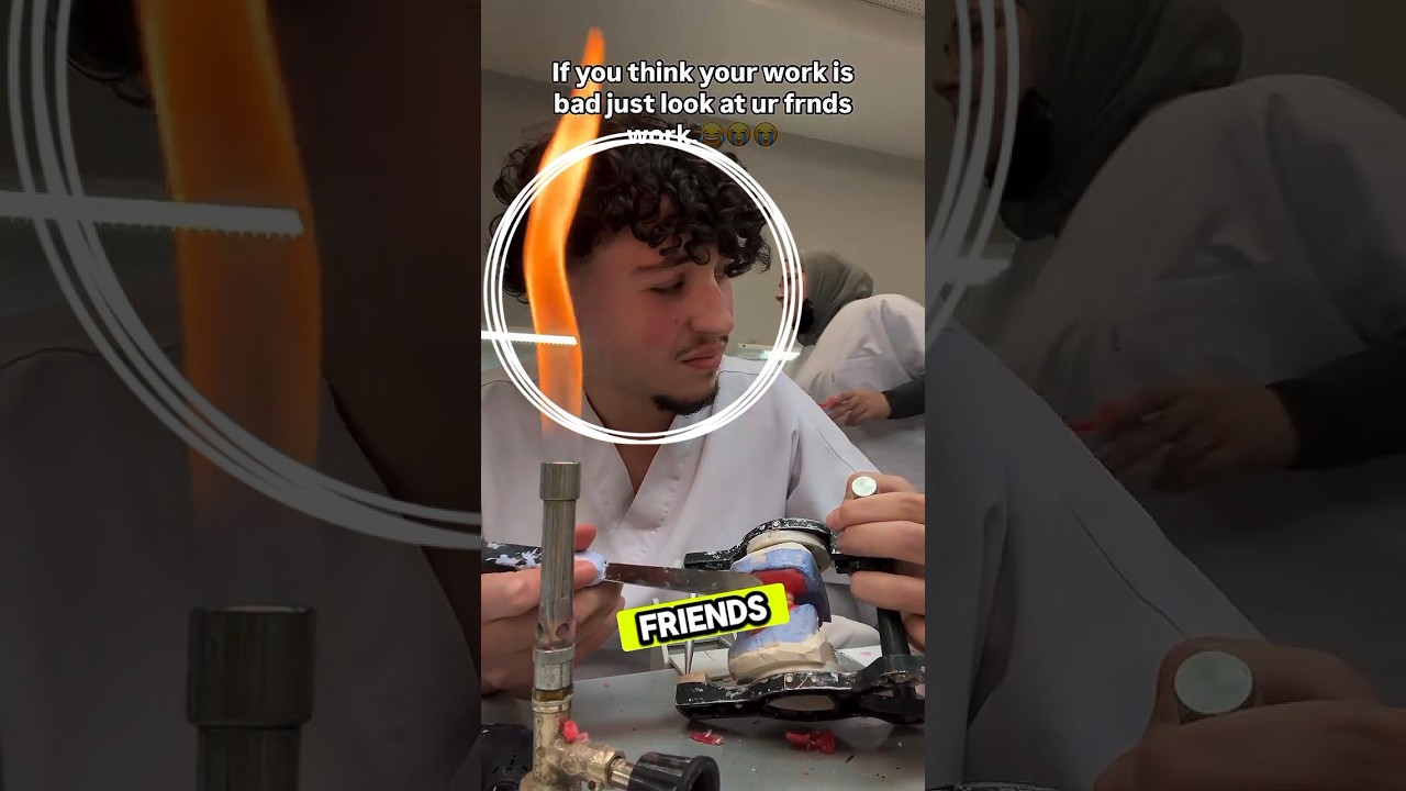 The denture failed miserably 