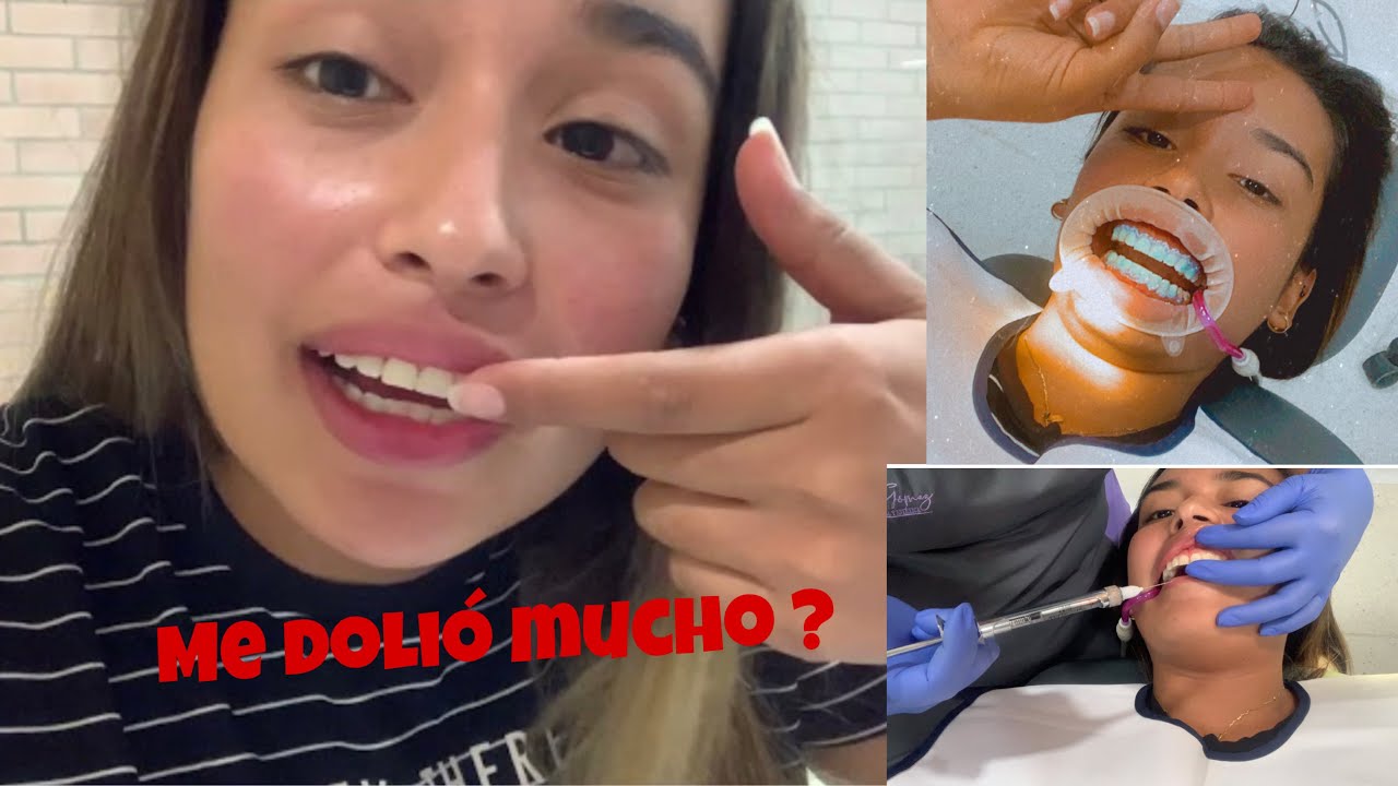 Mi experiencia con el RECORTE DE ENCÍAS | Mila Stunt