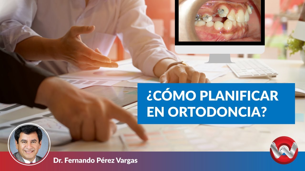 Como Planificar en Ortodoncia