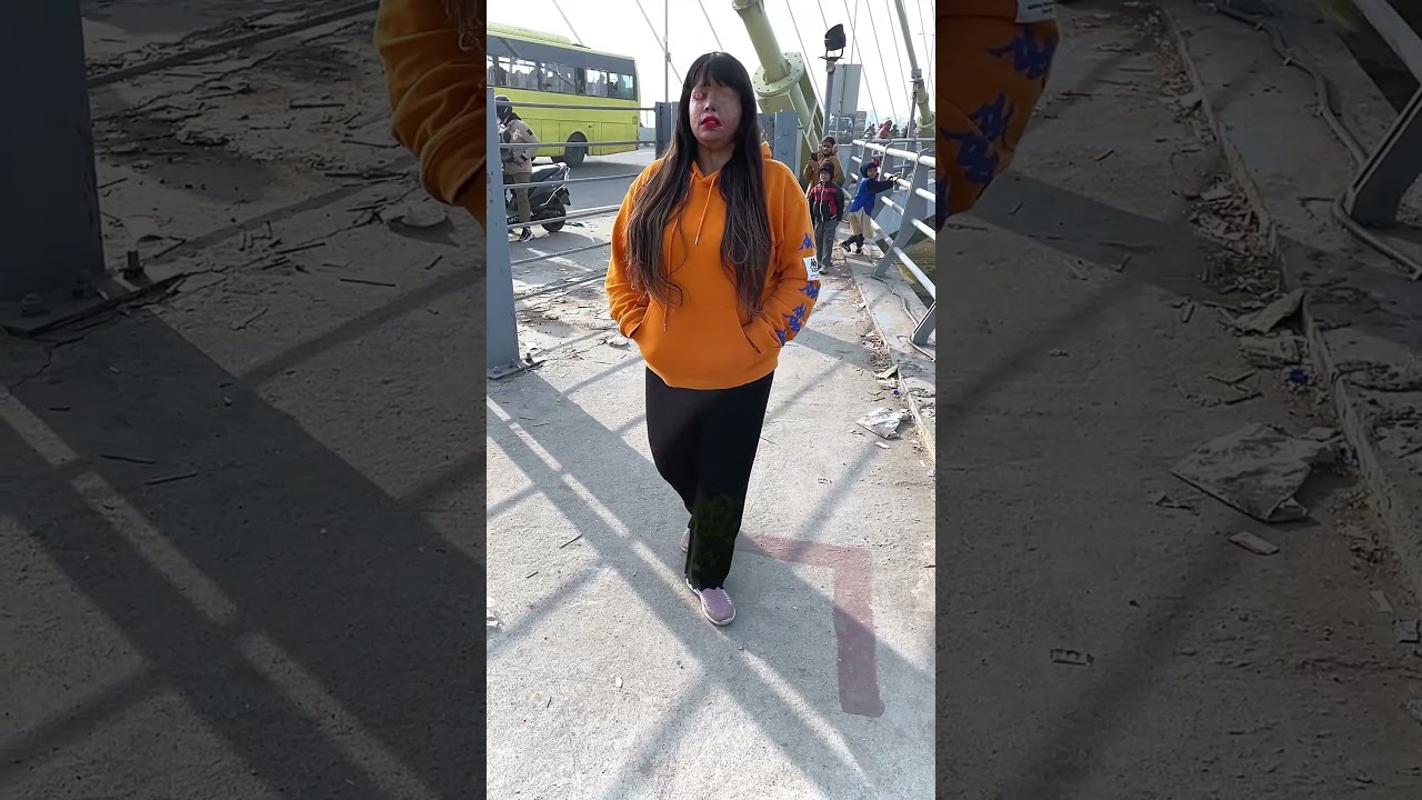 Before Acid Attack | after acid attack | Reshma Khatun Acid Survivor | #shots #sad #emotional