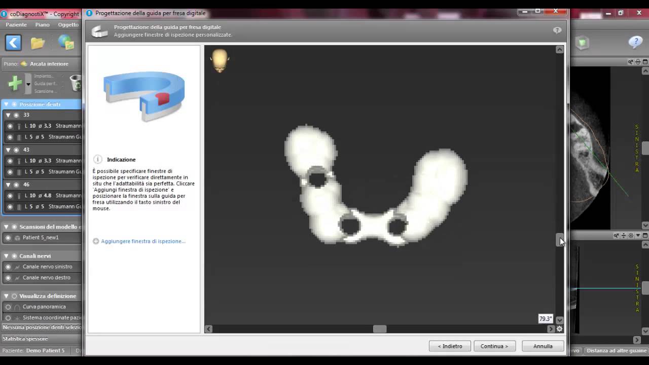 Tutorial n.8 Design della dima in coDiagnostiX