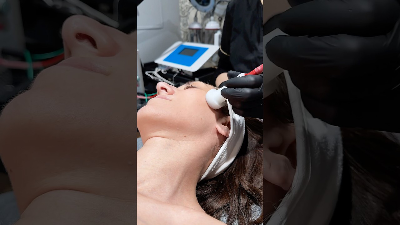 Bio Electro Peeling, zabieg, który robi różnicę! ✨ 