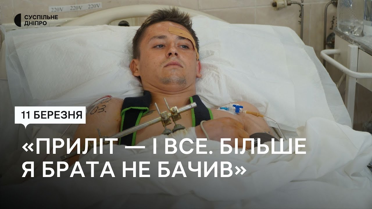 Втратив 16-річного брата: у Дніпрі лікують чоловіка, якого поранило під час обстрілу РФ