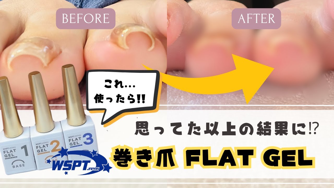 手軽に巻き爪ケアができるジェル！？検証しながらネイルチェンジします！WSPTジャパン巻き爪FLAT GEL