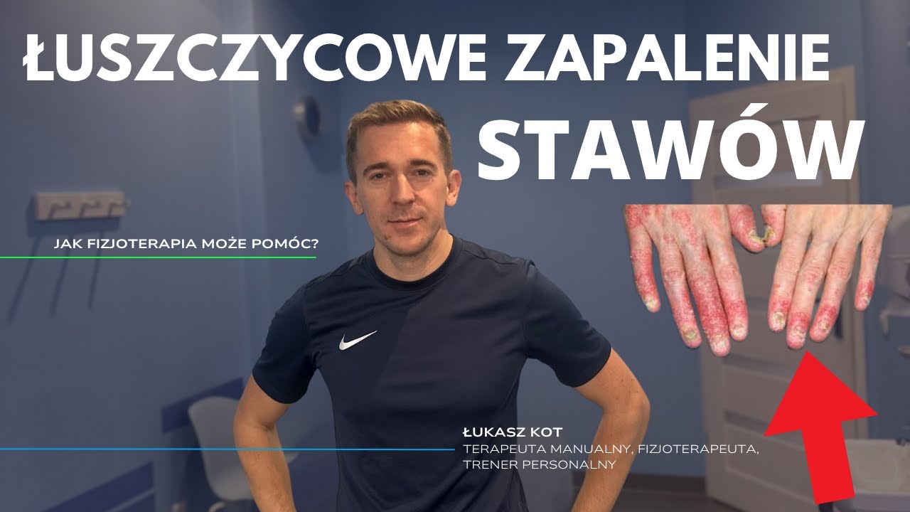 ŁUSZCZYCOWE ZAPALENIE STAWÓW. OBJAWY, FIZJOTERAPIA. (Łukasz Kot, fizjoidea)