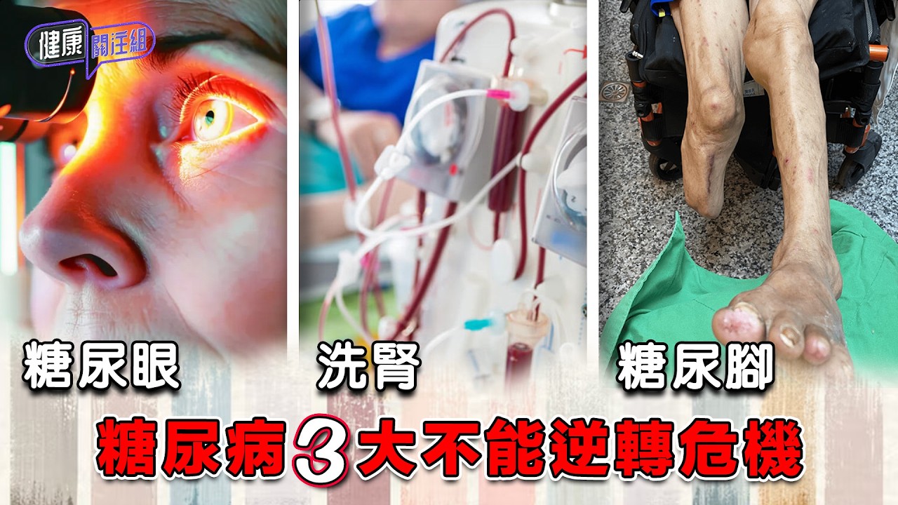 糖尿病3大不能逆轉危機 ｜ 健康關注組 ｜ EP529 ｜ 糖尿病 ｜ 腎衰竭 ｜ 洗腎 ｜ 糖尿眼 ｜ 糖尿腳 ｜ 截肢 ｜ 敖嘉年 ｜ 朱智賢 ｜ HOY TV 77台