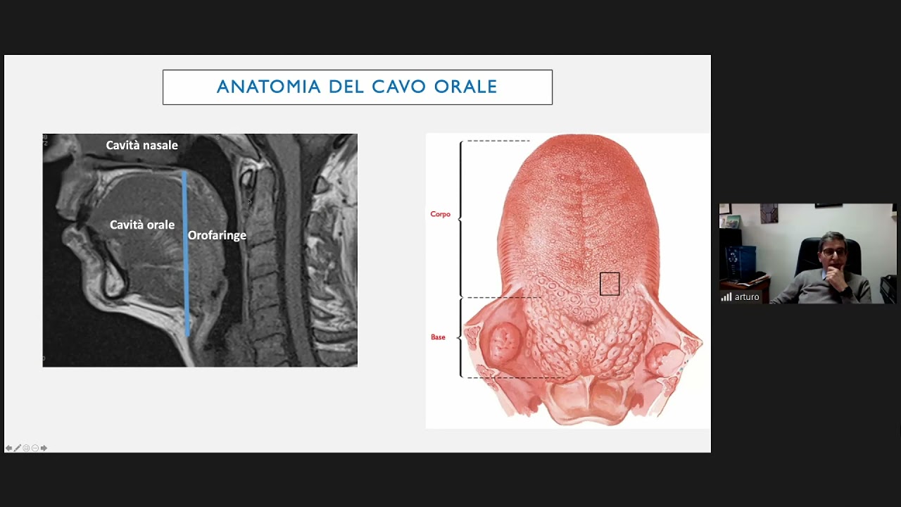 21.6) Le patologie neoplastiche del cavo orale - Prof. Arturo Brunetti