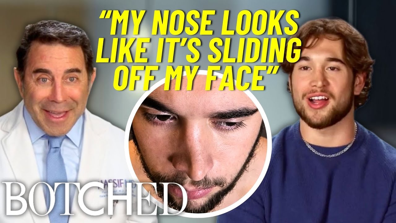 Zaverie Fixes His Crooked Nose After A Freak Accident & 20 Filler Injections | Botched | E!