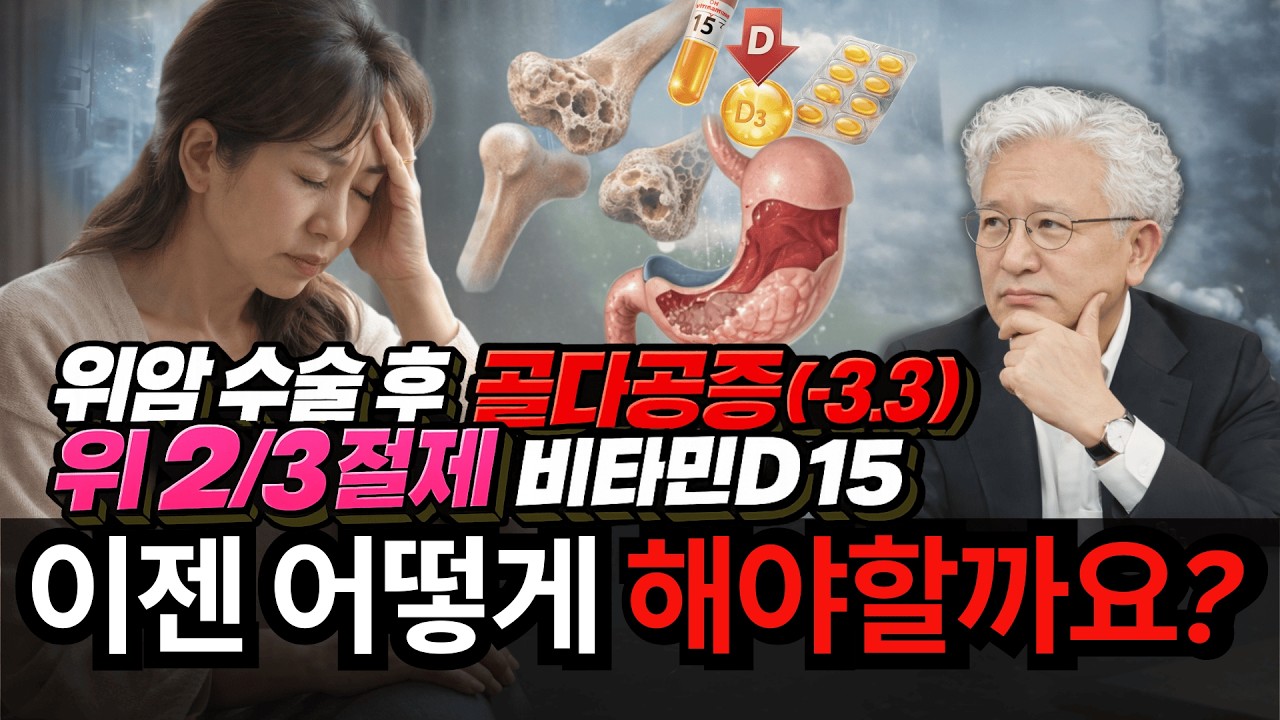 위암 수술 후 골다공증 이젠 어떻게 해야할까요?