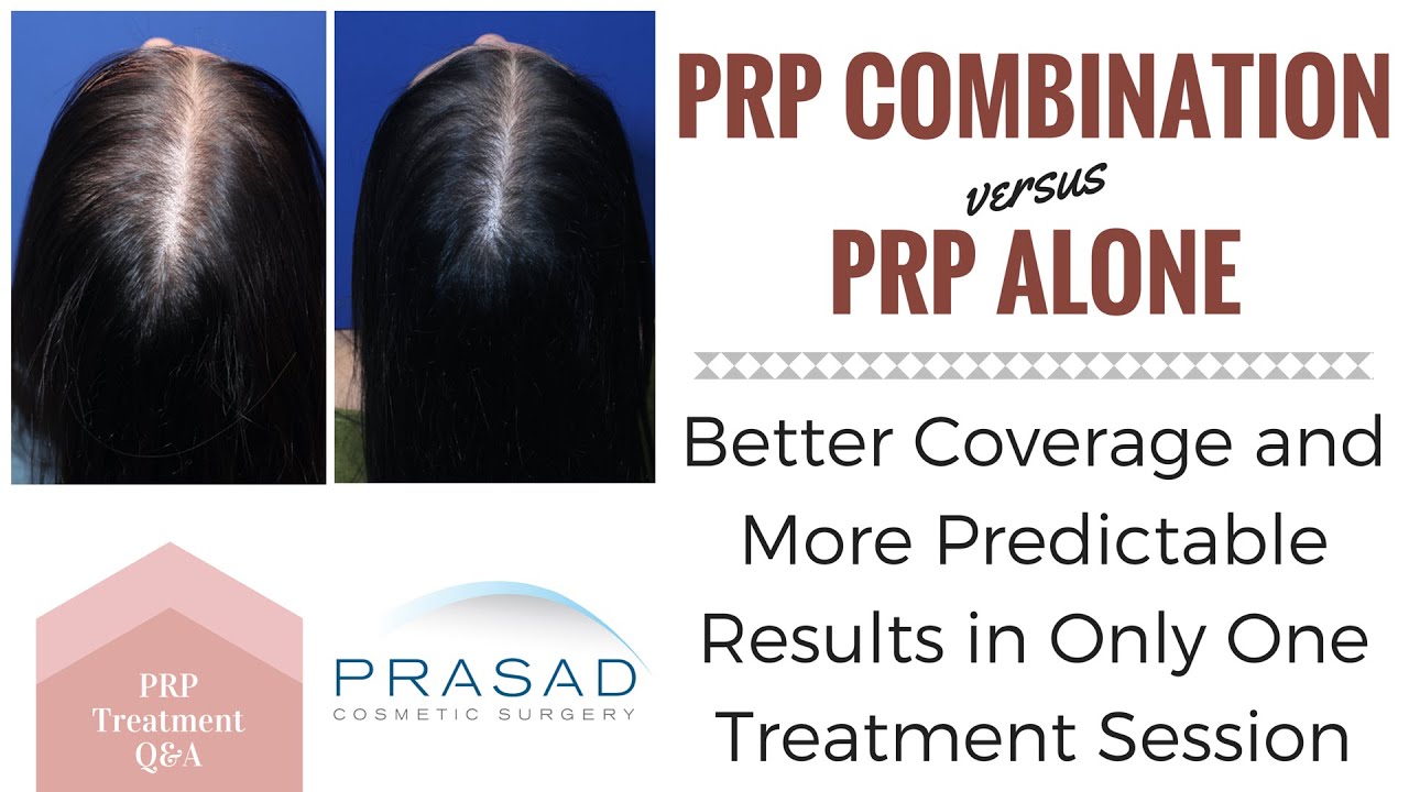 PRP for Female Hair Loss - More Coverage, Predictable Results with a One-Time PRP Combination