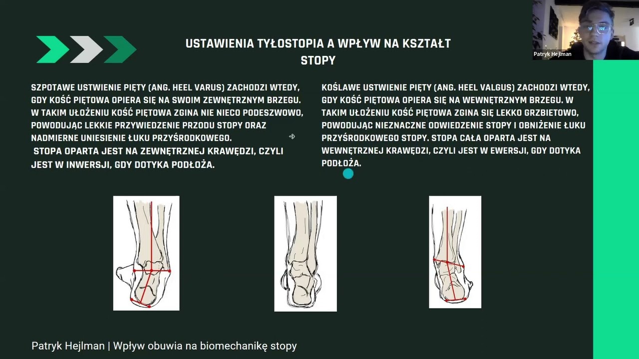 Wpływ obuwia na biomechanikę stóp. 👣MARATON PODOLOGII KLINICZNEJ 2022r🏃‍♂️ Patryk Hejlman