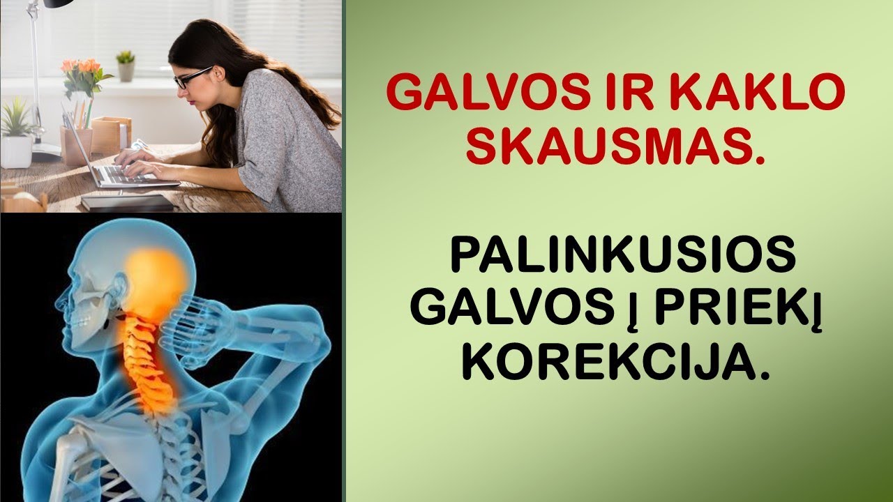 Galvos ir kaklo skausmas. Palinkusios galvos į priekį korekcija.