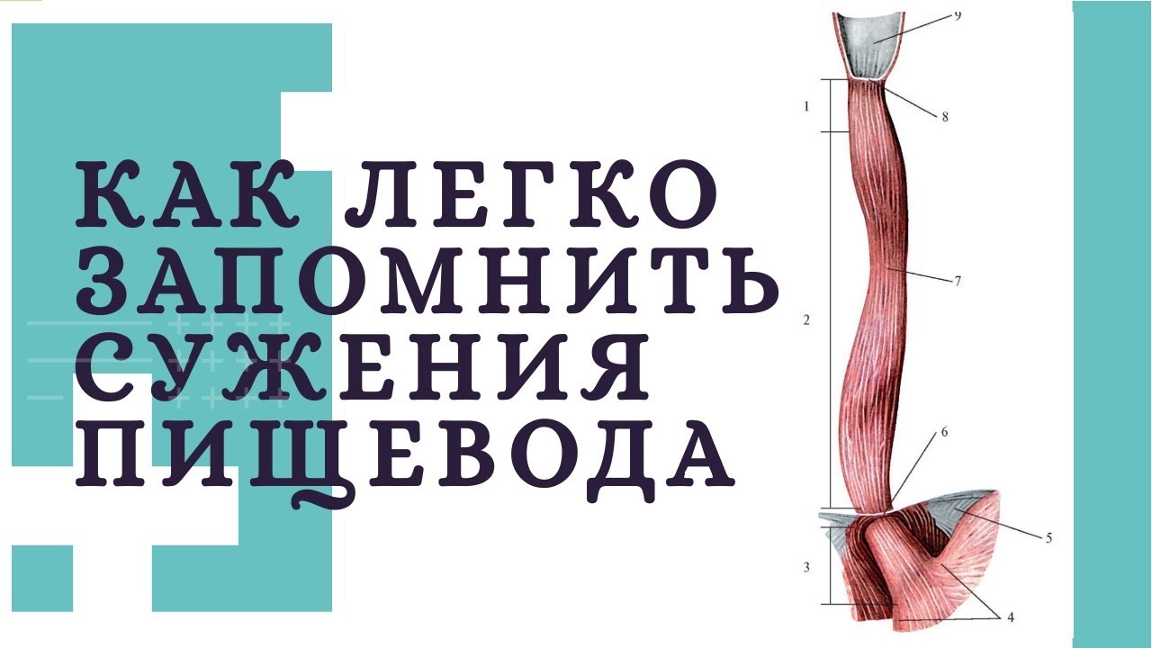 КАК ЛЕГКО ЗАПОМНИТЬ СУЖЕНИЯ ПИЩЕВОДА?