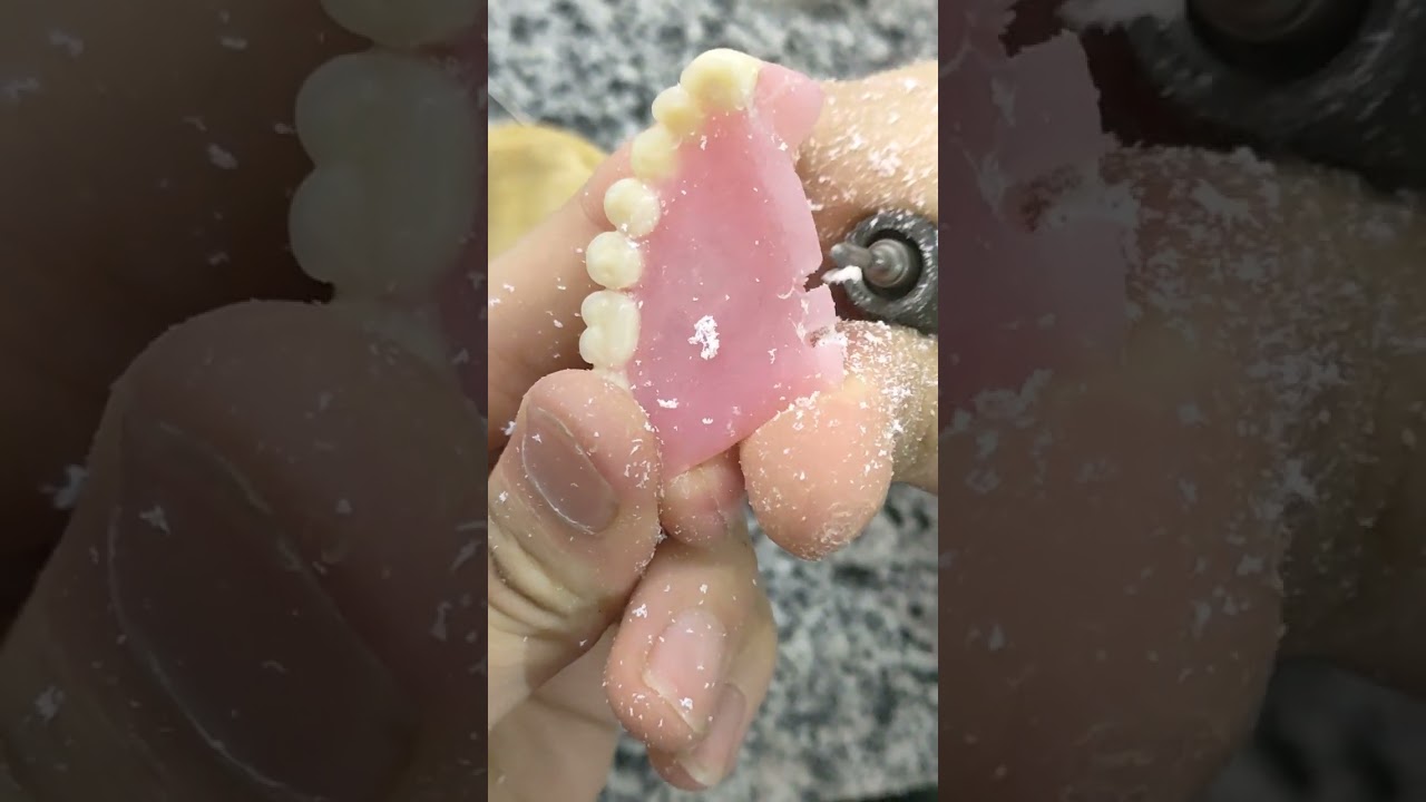 FIXING A BROKEN DENTURE كيفية إصلاح طقم الاسنان المتحرك #تصليح #dentist #dentures