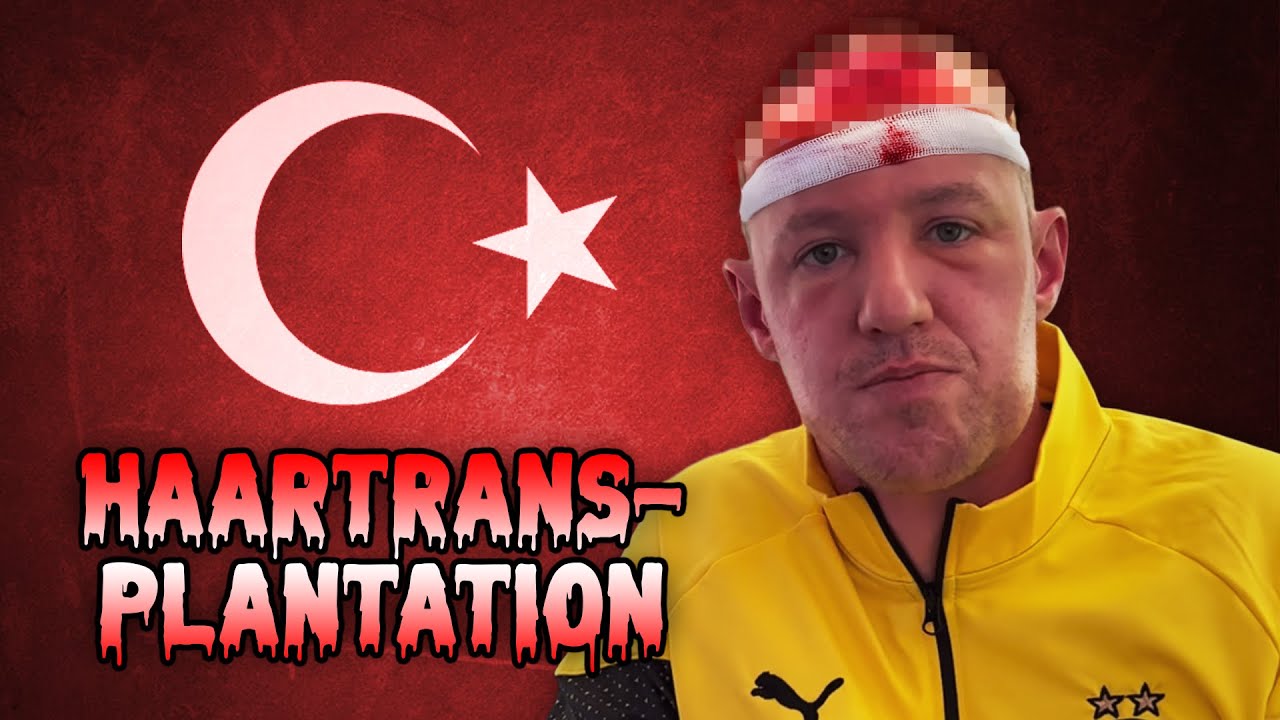 Horror Haartransplantation in Istanbul