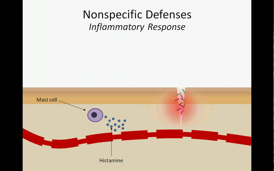 The Inflammatory Response