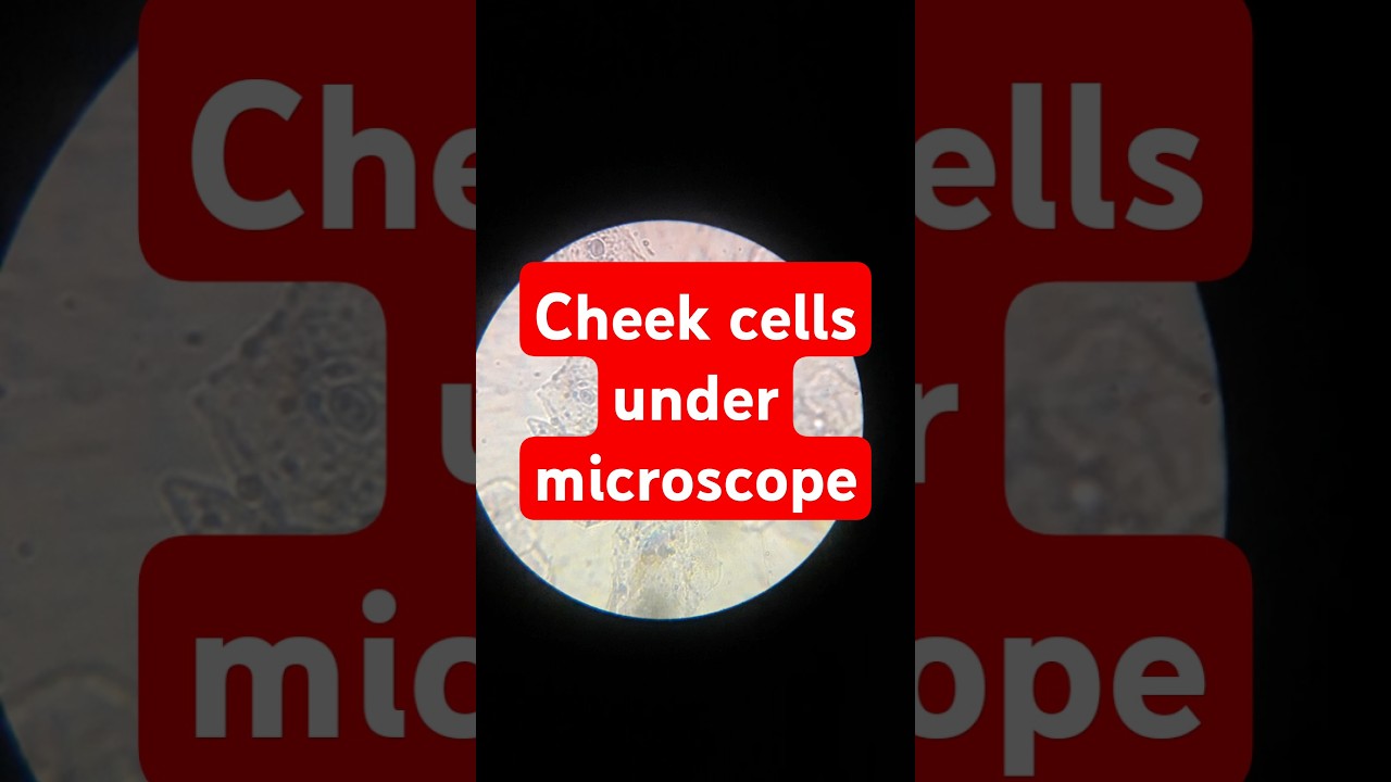 Cheek cells under microscope  @NatureisUltimate